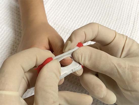 tring flex vinger aanbrengen